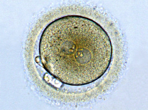 Zygote1